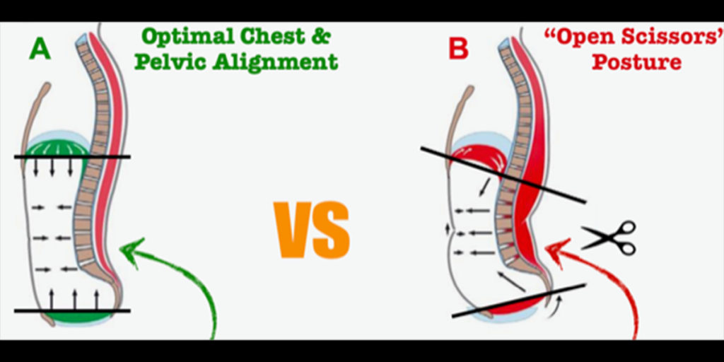 Open scissor posture, what is it and how you can change it Inspired
